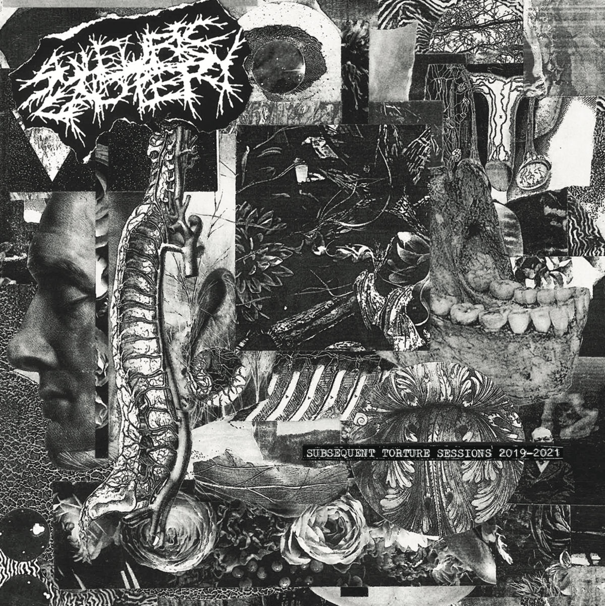 Sulfuric Cautery - Subsequent Torture Sessions 2019-2021 LP
