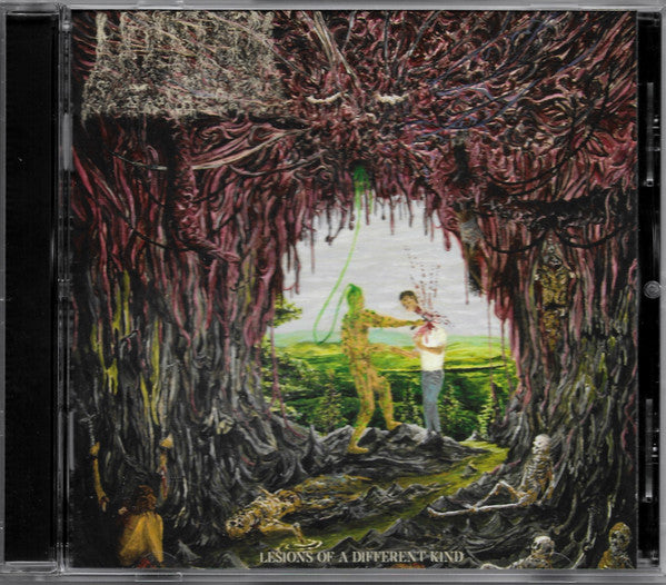 Undeath : Lesions Of A Different Kind (CD, Album)