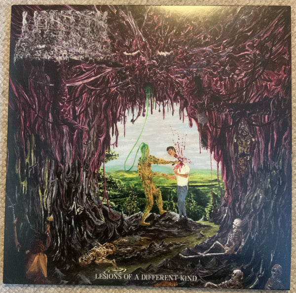 Undeath : Lesions Of A Different Kind (LP, Album, Ltd, Cok)